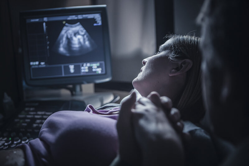 Pregnant woman observes as ultrasound is conducted